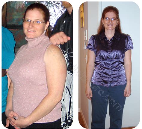 HCG Diet Fat loss Real Life Before & After .